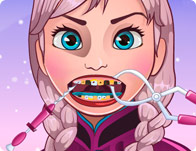 Jeu Dent glace pour Elsa reine des neiges